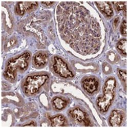 MFSD8, Rabbit, Polyclonal Antibody, Abnova 100 &mu;L | Buy Online | Abnova Corporation | Fisher Scientific