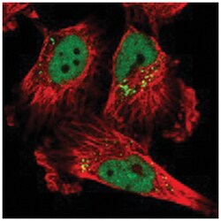 MFSD8, Rabbit, Polyclonal Antibody, Abnova 100 &mu;L | Buy Online | Abnova Corporation | Fisher Scientific