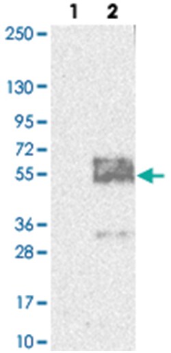 MFSD8, Rabbit, Polyclonal Antibody, Abnova 100 &mu;L | Buy Online | Abnova Corporation | Fisher Scientific