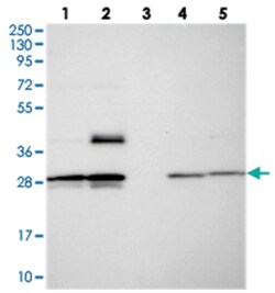 MXRA7, Rabbit, Polyclonal Antibody, Abnova 100&mu;L; Unlabeled:Antibodies,