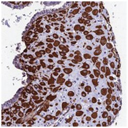 MXRA7, Rabbit, Polyclonal Antibody, Abnova 100&mu;L; Unlabeled:Antibodies,
