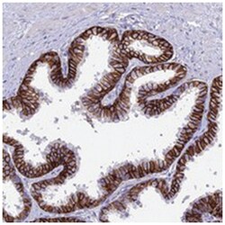 OR1Q1, Rabbit, Polyclonal Antibody, Abnova 100&mu;L; Unlabeled:Antibodies,