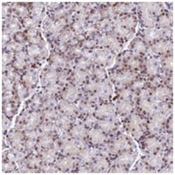 MYEOV2, Rabbit, Polyclonal Antibody, Abnova 100 &mu;L | Buy Online | Abnova Corporation | Fisher Scientific