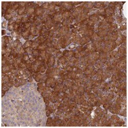 ZFYVE20, Rabbit, Polyclonal Antibody, Abnova 100 &mu;L | Buy Online | Abnova Corporation | Fisher Scientific