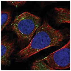 ZFYVE20, Rabbit, Polyclonal Antibody, Abnova 100 &mu;L | Buy Online | Abnova Corporation | Fisher Scientific