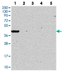 GIMAP1, Rabbit, Polyclonal Antibody, Abnova 100 &mu;L | Buy Online | Abnova Corporation | Fisher Scientific