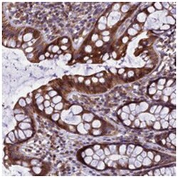 GIMAP1, Rabbit, Polyclonal Antibody, Abnova 100 &mu;L | Buy Online | Abnova Corporation | Fisher Scientific