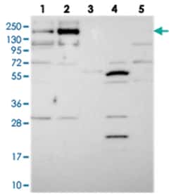 TMEM2, Rabbit, Polyclonal Antibody, Abnova 100 &mu;L | Buy Online | Abnova Corporation | Fisher Scientific