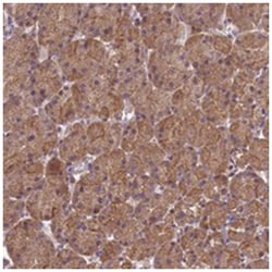 TMEM2, Rabbit, Polyclonal Antibody, Abnova 100 &mu;L | Buy Online | Abnova Corporation | Fisher Scientific