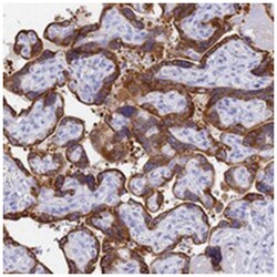 C2orf72, Rabbit, Polyclonal Antibody, Abnova 100 &mu;L | Buy Online | Abnova Corporation | Fisher Scientific