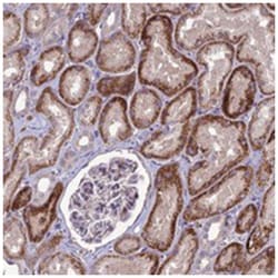 C2orf76, Rabbit, Polyclonal Antibody, Abnova 100 &mu;L | Buy Online | Abnova Corporation | Fisher Scientific