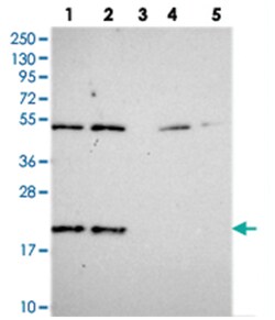 KIAA1143, Rabbit, Polyclonal Antibody, Abnova 100 &mu;L | Buy Online | Abnova Corporation | Fisher Scientific