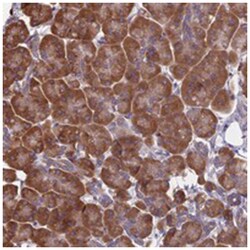 KIAA1143, Rabbit, Polyclonal Antibody, Abnova 100 &mu;L | Buy Online | Abnova Corporation | Fisher Scientific