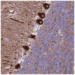 CLEC2L, Rabbit, Polyclonal Antibody, Abnova 100 &mu;L | Buy Online | Abnova Corporation | Fisher Scientific
