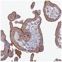 PROX2, Rabbit, Polyclonal Antibody, Abnova 100 &mu;L | Buy Online | Abnova Corporation | Fisher Scientific