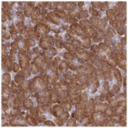 HM13, Rabbit, Polyclonal Antibody, Abnova 100 &mu;L | Buy Online | Abnova Corporation | Fisher Scientific