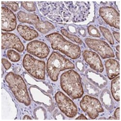 ALG3, Rabbit, Polyclonal Antibody, Abnova 100 &mu;L | Buy Online | Abnova Corporation | Fisher Scientific
