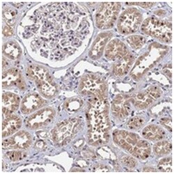 C20orf111, Rabbit, Polyclonal Antibody, Abnova 100 &mu;L | Buy Online | Abnova Corporation | Fisher Scientific