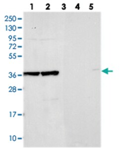ACTL6B Rabbit anti-Human, Polyclonal Antibody, Abnova 100&mu;L; Unlabeled:Antibodies,