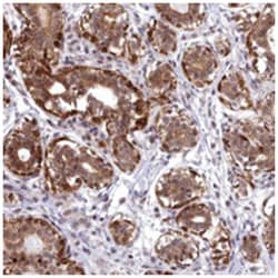 ABCB8, Rabbit, Polyclonal Antibody, Abnova 100&mu;L; Unlabeled:Antibodies,