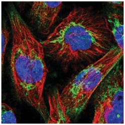 ABCB8, Rabbit, Polyclonal Antibody, Abnova 100&mu;L; Unlabeled:Antibodies,