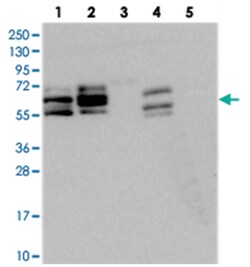 BICC1, Rabbit, Polyclonal Antibody, Abnova 100 &mu;L | Buy Online | Abnova Corporation | Fisher Scientific