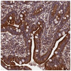 BICC1, Rabbit, Polyclonal Antibody, Abnova 100 &mu;L | Buy Online | Abnova Corporation | Fisher Scientific