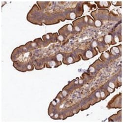 TMEM74B, Rabbit, Polyclonal Antibody, Abnova 100 &mu;L | Buy Online | Abnova Corporation | Fisher Scientific
