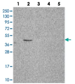 C2orf69, Rabbit, Polyclonal Antibody, Abnova 100 &mu;L | Buy Online | Abnova Corporation | Fisher Scientific