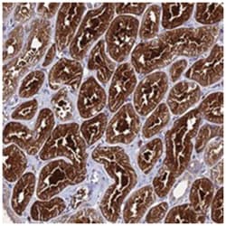 C2orf69, Rabbit, Polyclonal Antibody, Abnova 100 &mu;L | Buy Online | Abnova Corporation | Fisher Scientific