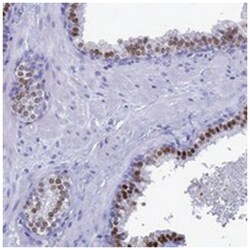 TMEM244, Rabbit, Polyclonal Antibody, Abnova 100 &mu;L | Buy Online | Abnova Corporation | Fisher Scientific