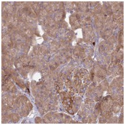 TXLNA Rabbit anti-Human, Polyclonal Antibody, Abnova 100&mu;L; Unlabeled:Antibodies,