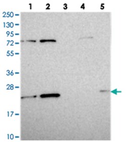 EIF3K Rabbit anti-Human, Polyclonal Antibody, Abnova 100&mu;L; Unlabeled:Antibodies,