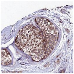 EIF3K Rabbit anti-Human, Polyclonal Antibody, Abnova 100&mu;L; Unlabeled:Antibodies,