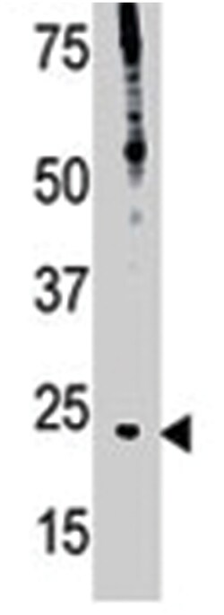 BID Rabbit anti-Human, Polyclonal Antibody, Abnova 400 &mu;L | Buy Online | Abnova Corporation | Fisher Scientific