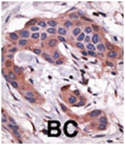 BID Rabbit anti-Human, Polyclonal Antibody, Abnova 400 &mu;L | Buy Online | Abnova Corporation | Fisher Scientific