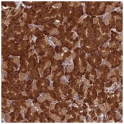 NXNL2, Rabbit, Polyclonal Antibody, Abnova 100&mu;L; Unlabeled:Antibodies,