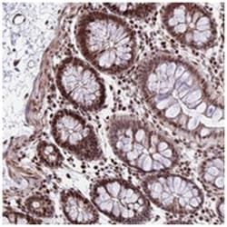 NYAP2, Rabbit, Polyclonal Antibody, Abnova 100 &mu;L | Buy Online | Abnova Corporation | Fisher Scientific