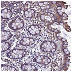 ZNF235, Rabbit, Polyclonal Antibody, Abnova 100 &mu;L | Buy Online | Abnova Corporation | Fisher Scientific