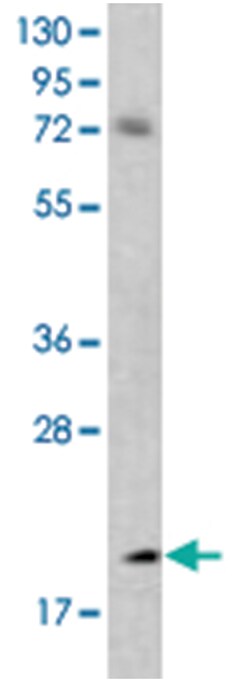 BMF Rabbit anti-Human, Polyclonal Antibody, Abnova 400 &mu;L | Buy Online | Abnova Corporation | Fisher Scientific