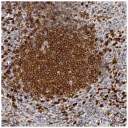 IL4I1, Rabbit, Polyclonal Antibody, Abnova 100 &mu;L | Buy Online | Abnova Corporation | Fisher Scientific