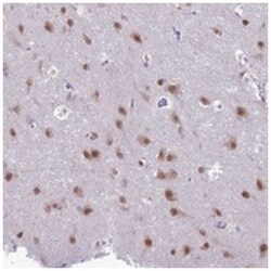 NOVA2, Rabbit, Polyclonal Antibody, Abnova 100&mu;L; Unlabeled:Antibodies,