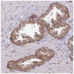 CCDC9, Rabbit, Polyclonal Antibody, Abnova 100 &mu;L | Buy Online | Abnova Corporation | Fisher Scientific