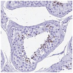 PATE4, Rabbit, Polyclonal Antibody, Abnova 100&mu;L; Unlabeled:Anticuerpos