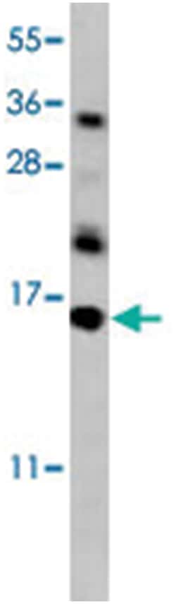 HRK Rabbit anti-Human, Mouse, Polyclonal Antibody, Abnova 400 &mu;L | Buy Online | Abnova Corporation | Fisher Scientific