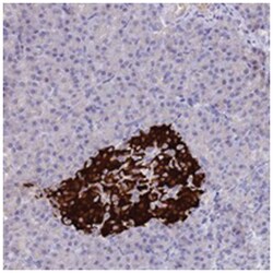 CCDC36, Rabbit, Polyclonal Antibody, Abnova 100 &mu;L | Buy Online | Abnova Corporation | Fisher Scientific