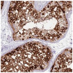 EVPLL, Rabbit, Polyclonal Antibody, Abnova 100 &mu;L | Buy Online | Abnova Corporation | Fisher Scientific