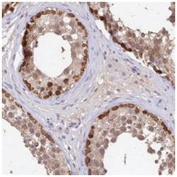 C10orf55, Rabbit, Polyclonal Antibody, Abnova 100 &mu;L | Buy Online | Abnova Corporation | Fisher Scientific