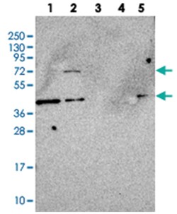 MOCS1, Rabbit, Polyclonal Antibody, Abnova 100&mu;L; Unlabeled:Antibodies,