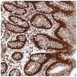 MOCS1, Rabbit, Polyclonal Antibody, Abnova 100&mu;L; Unlabeled:Antibodies,